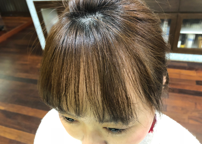 ヘアループ施術前
